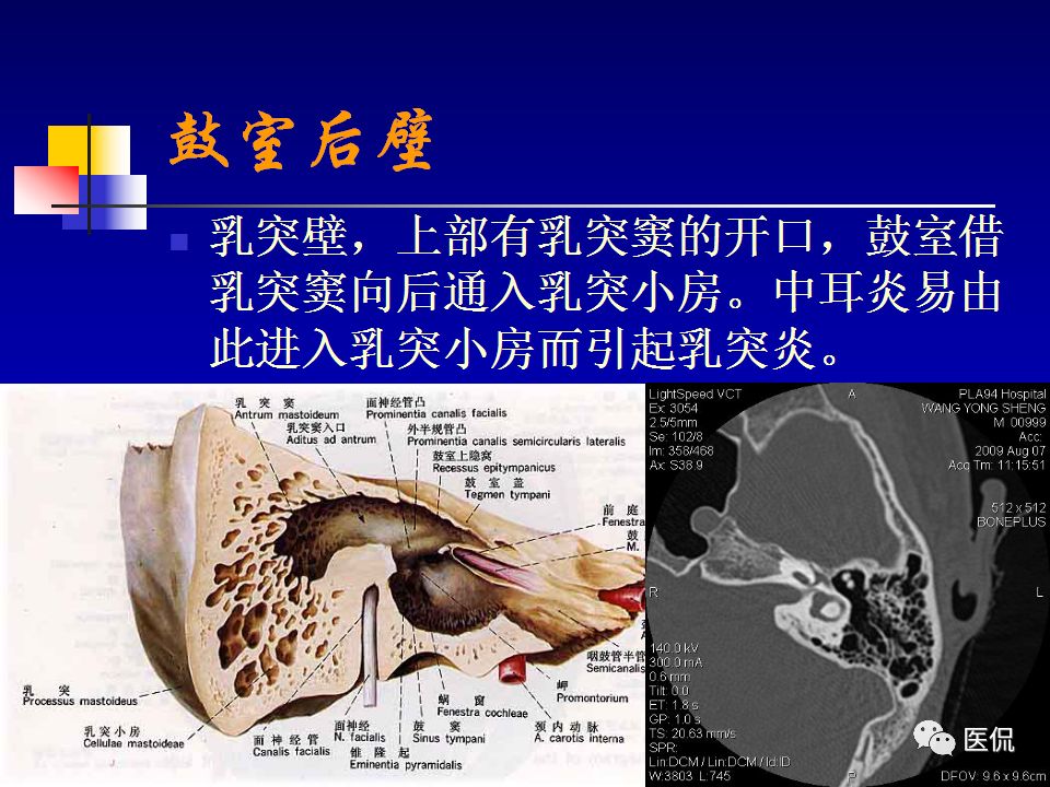 影像PPT - 【PPT】耳部影像诊断-12