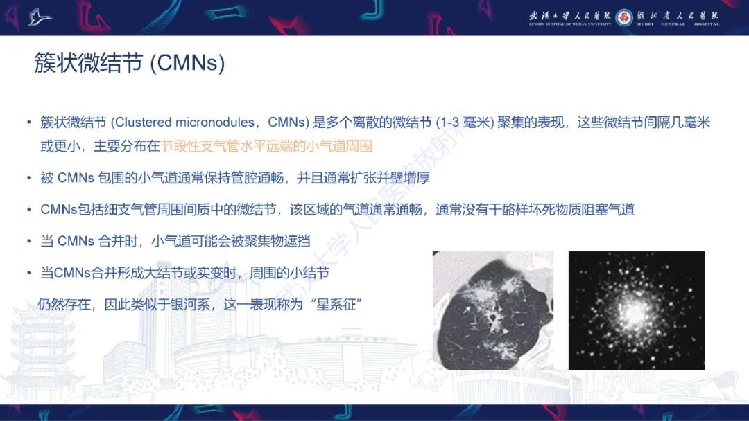 影像PPT - 【PPT】活动性肺结核不典型CT表现-8