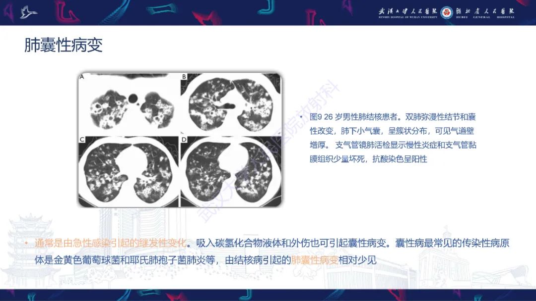 影像PPT - 【PPT】活动性肺结核不典型CT表现-18