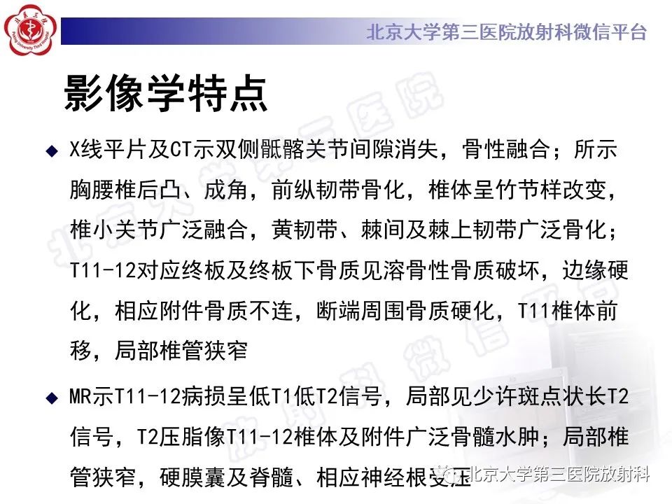 影像PPT - 【PPT】强直性脊柱炎合并ANDERSSON损害-9