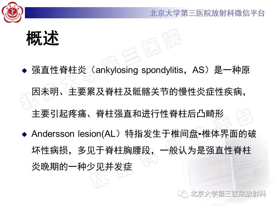 影像PPT - 【PPT】强直性脊柱炎合并ANDERSSON损害-11