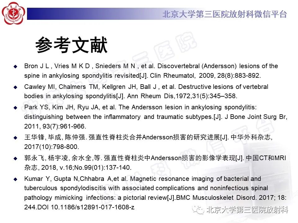 影像PPT - 【PPT】强直性脊柱炎合并ANDERSSON损害-30