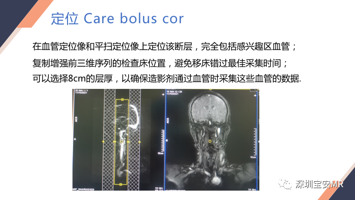 影像PPT - 【PPT】头颈CE-MRA扫描技术-7