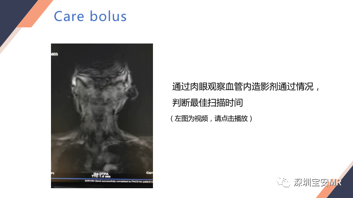 影像PPT - 【PPT】头颈CE-MRA扫描技术-6