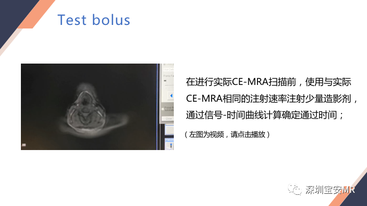 影像PPT - 【PPT】头颈CE-MRA扫描技术-10