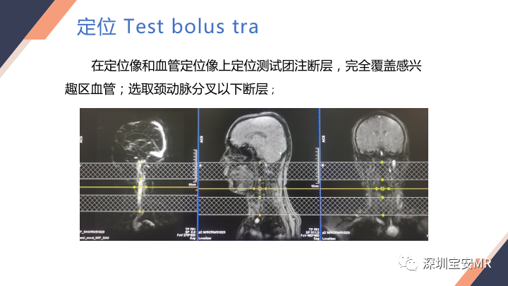 影像PPT - 【PPT】头颈CE-MRA扫描技术-11