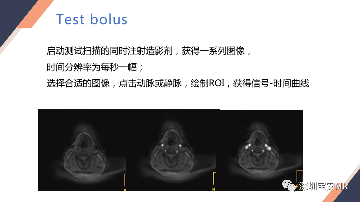 影像PPT - 【PPT】头颈CE-MRA扫描技术-12