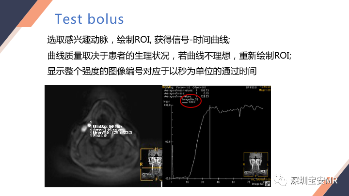影像PPT - 【PPT】头颈CE-MRA扫描技术-13