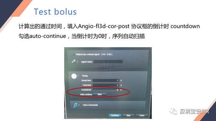 影像PPT - 【PPT】头颈CE-MRA扫描技术-15