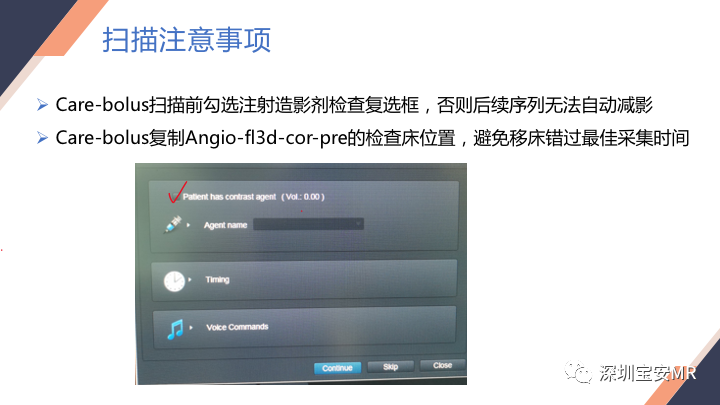 影像PPT - 【PPT】头颈CE-MRA扫描技术-22