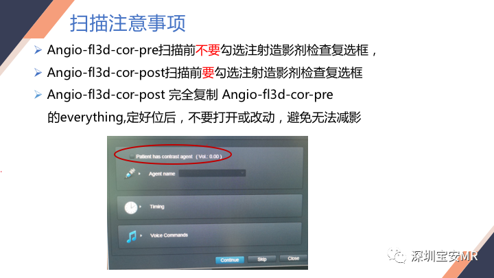 影像PPT - 【PPT】头颈CE-MRA扫描技术-23