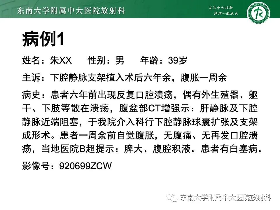 影像PPT - 【PPT】布加综合征-3