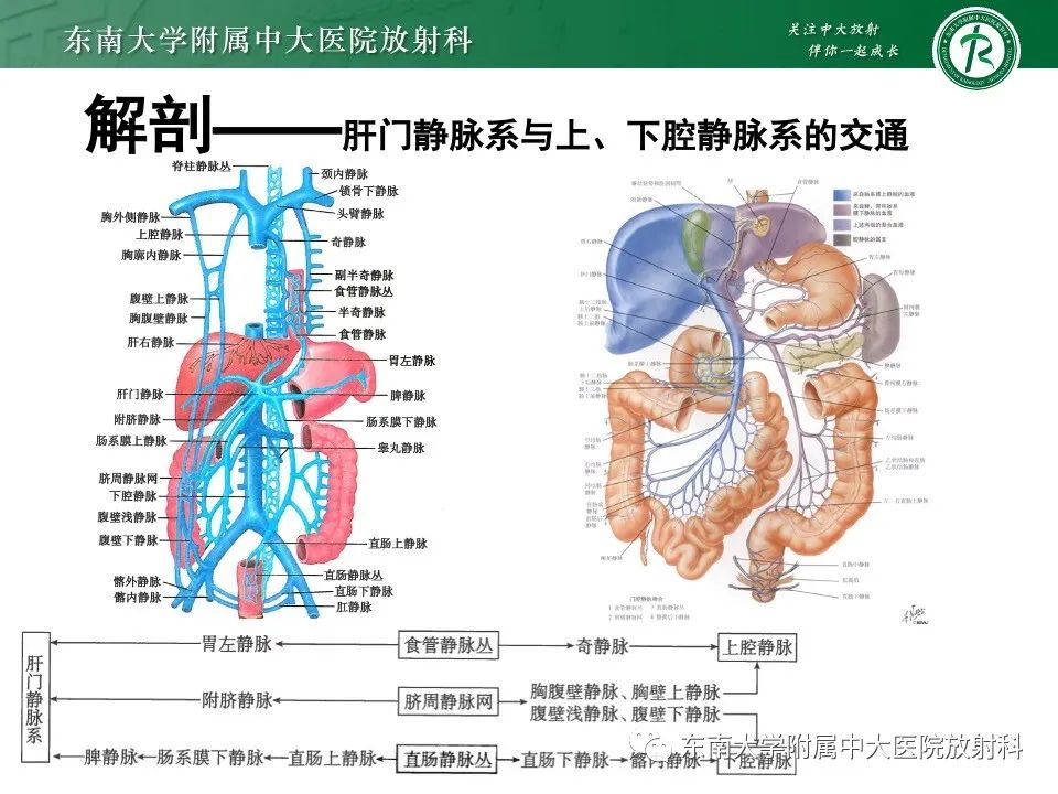 影像PPT - 【PPT】布加综合征-7