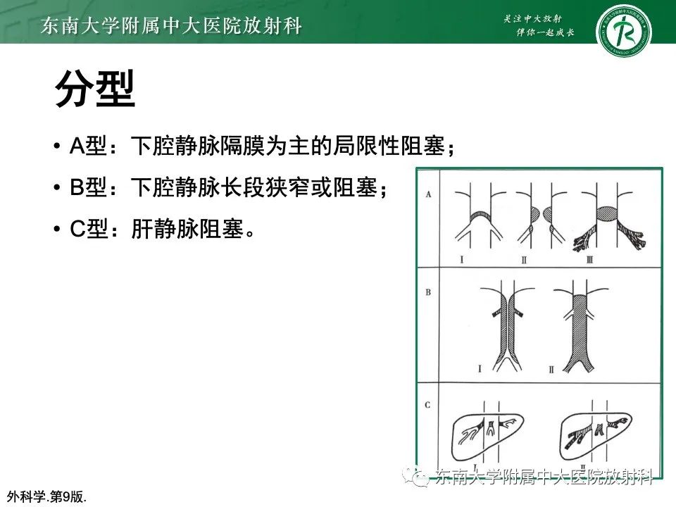 影像PPT - 【PPT】布加综合征-9