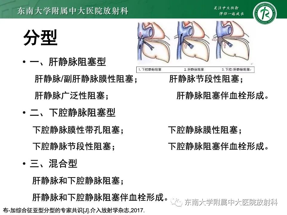 影像PPT - 【PPT】布加综合征-10