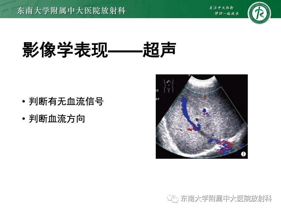 影像PPT - 【PPT】布加综合征-14