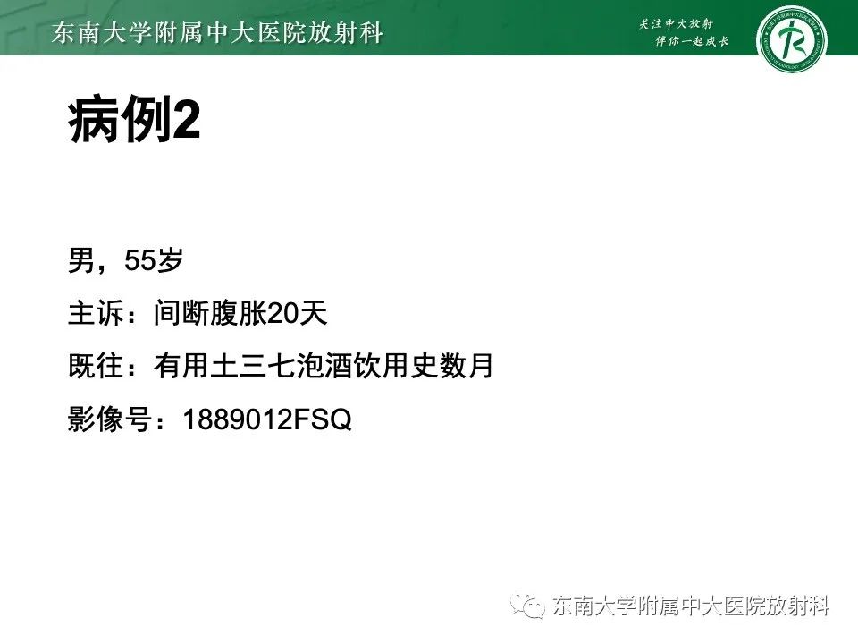 影像PPT - 【PPT】布加综合征-22