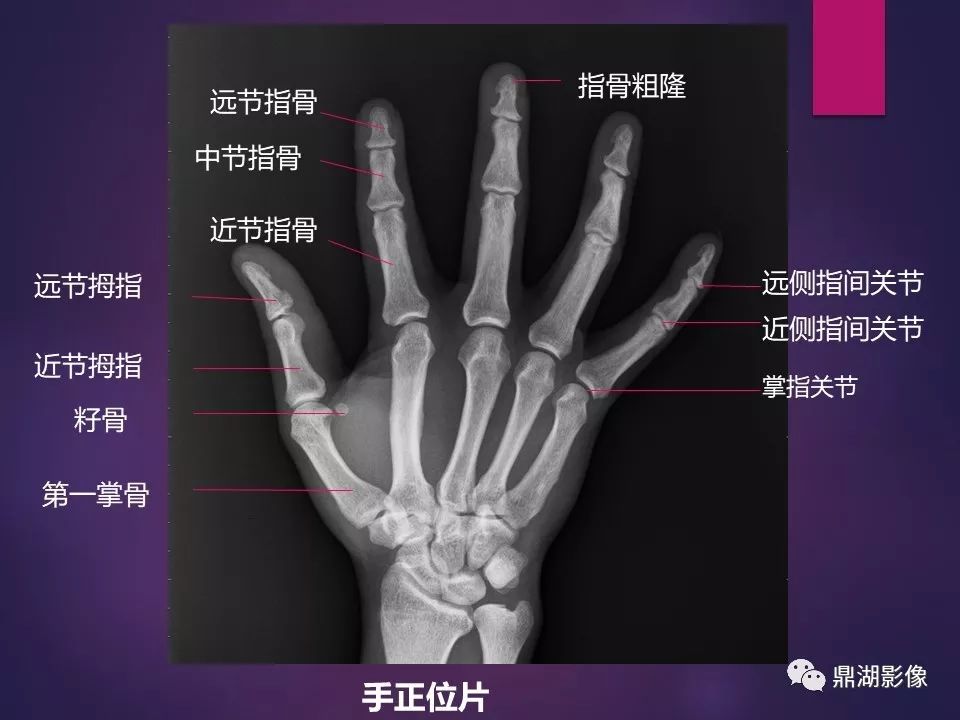 影像PPT - 【PPT】骨骼肌肉系统医学影像解剖-3