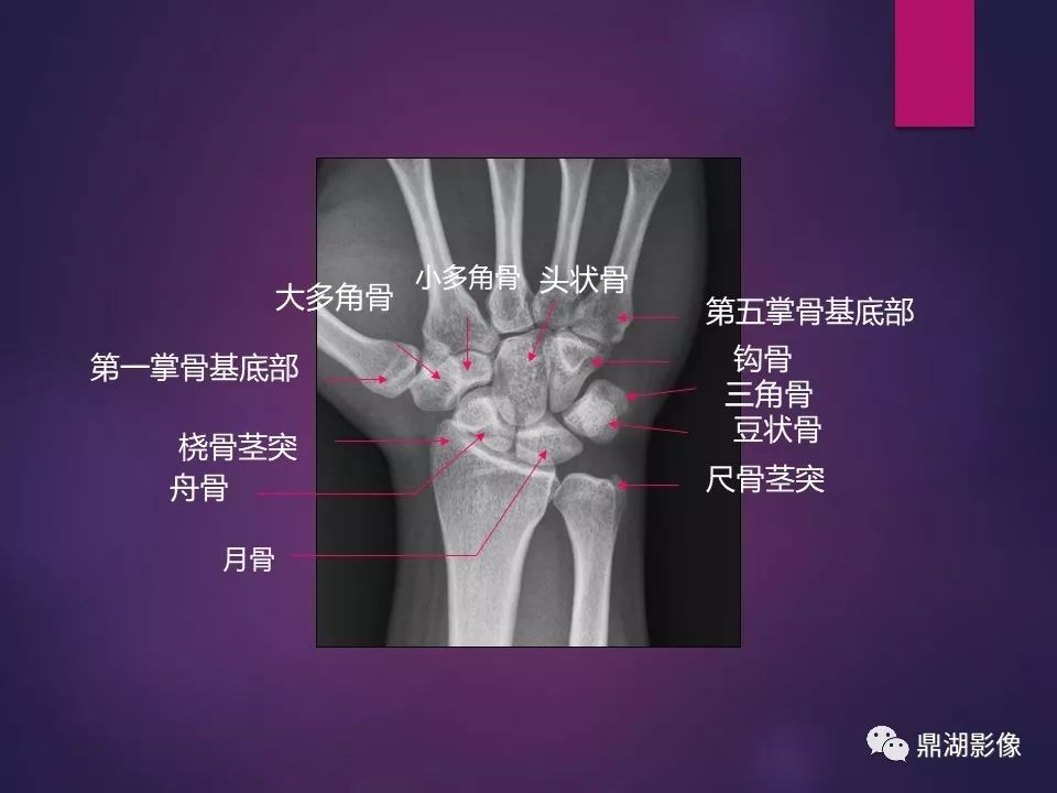 影像PPT - 【PPT】骨骼肌肉系统医学影像解剖-5