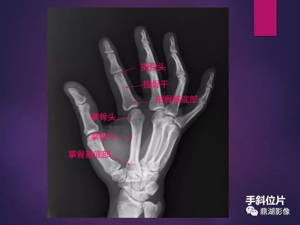 影像PPT - 【PPT】骨骼肌肉系统医学影像解剖-4