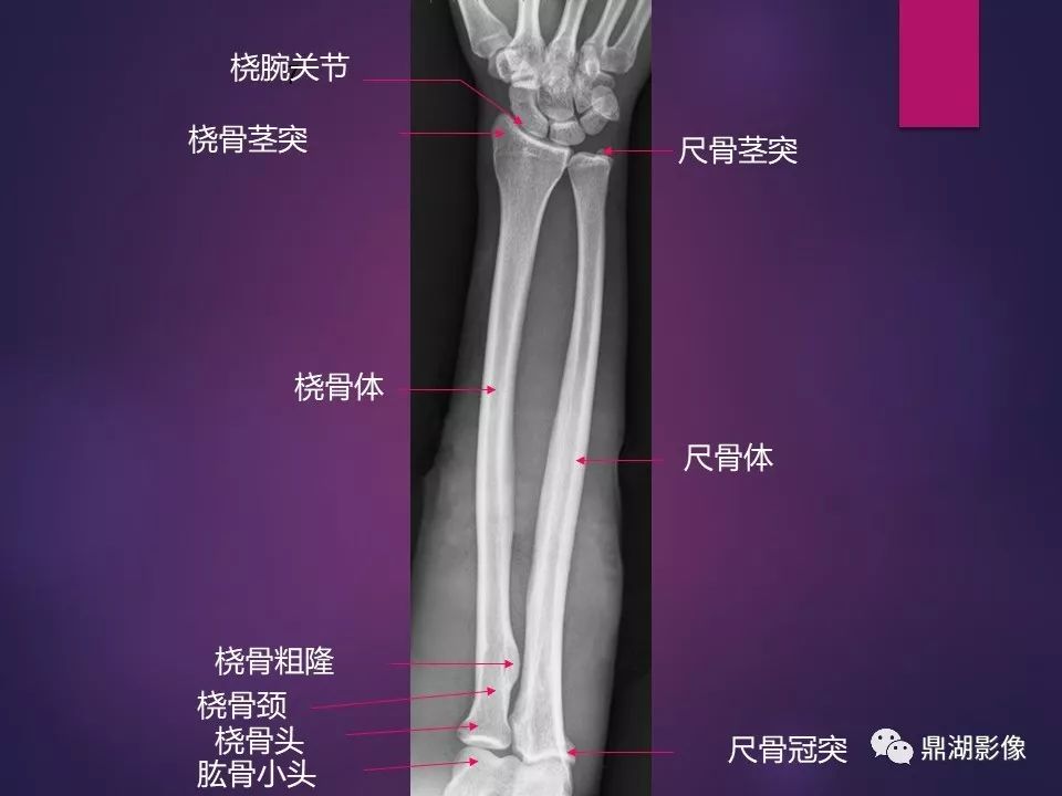 影像PPT - 【PPT】骨骼肌肉系统医学影像解剖-6