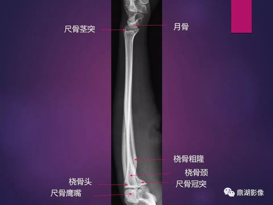影像PPT - 【PPT】骨骼肌肉系统医学影像解剖-7
