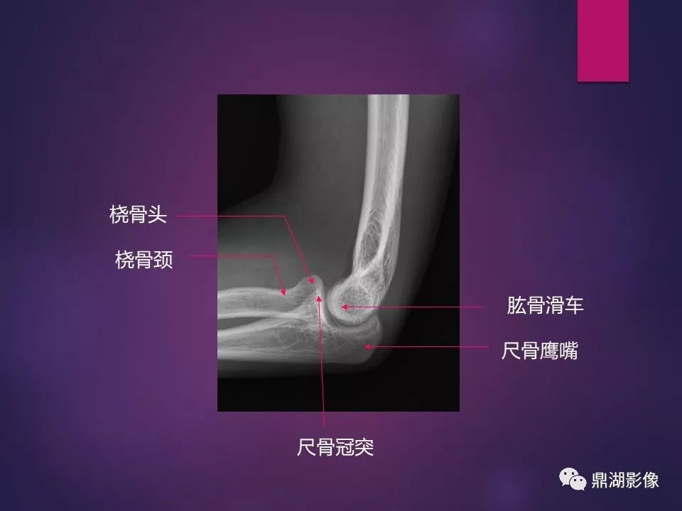 影像PPT - 【PPT】骨骼肌肉系统医学影像解剖-9
