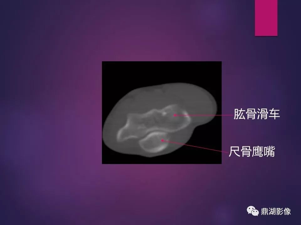 影像PPT - 【PPT】骨骼肌肉系统医学影像解剖-10