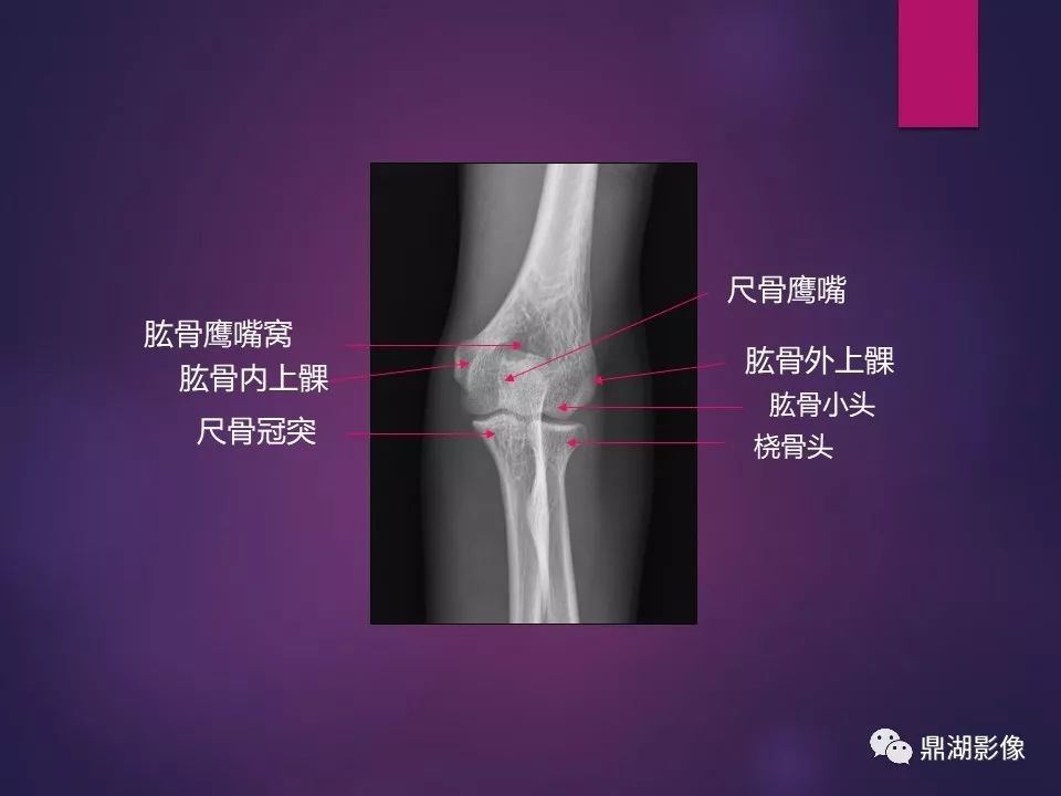 影像PPT - 【PPT】骨骼肌肉系统医学影像解剖-8