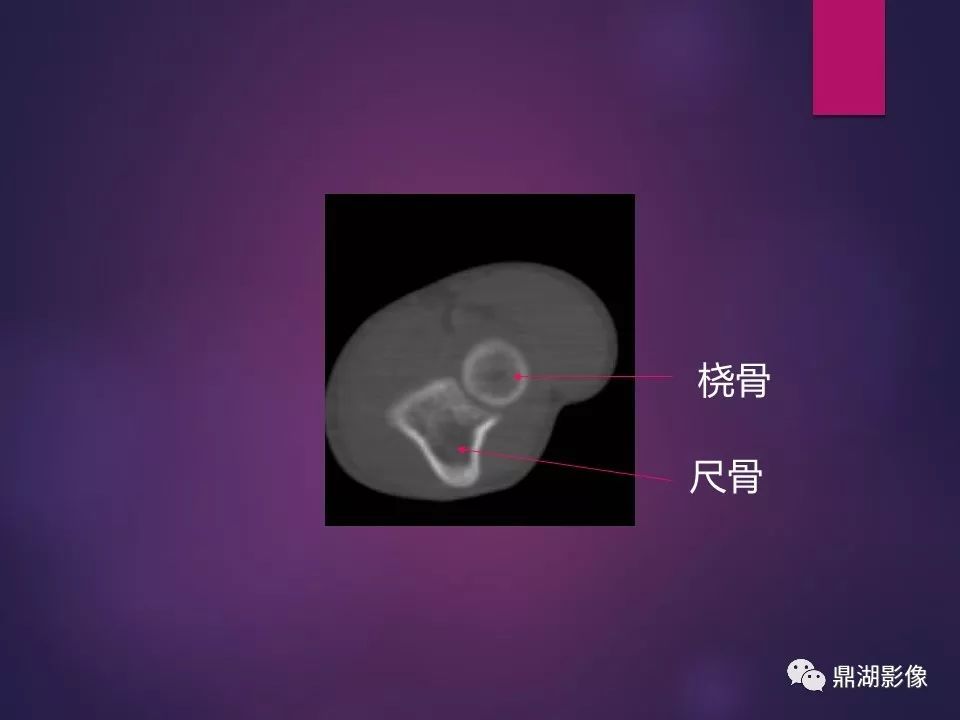 影像PPT - 【PPT】骨骼肌肉系统医学影像解剖-11