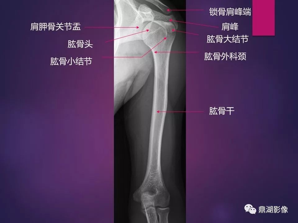 影像PPT - 【PPT】骨骼肌肉系统医学影像解剖-12