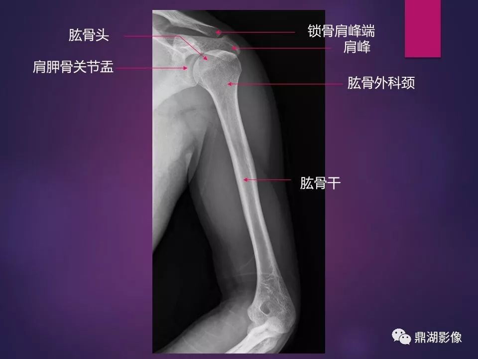 影像PPT - 【PPT】骨骼肌肉系统医学影像解剖-13