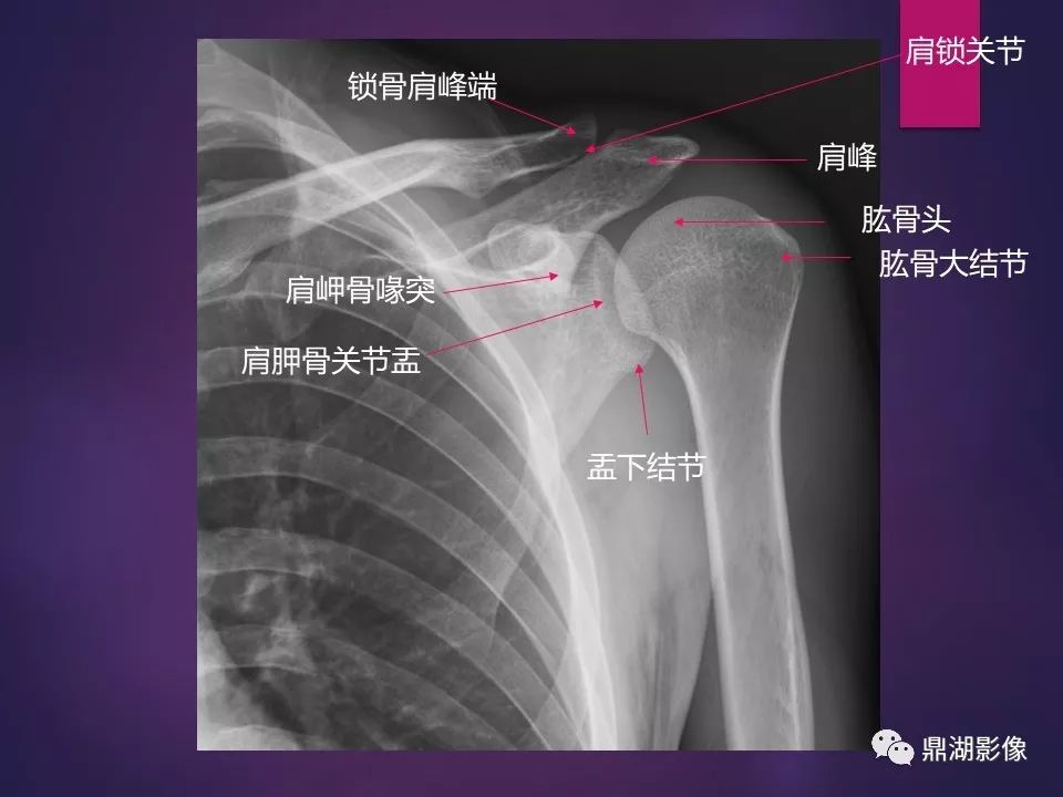 影像PPT - 【PPT】骨骼肌肉系统医学影像解剖-14