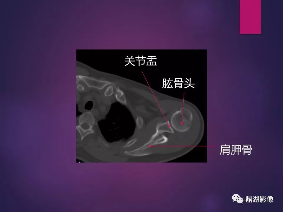 影像PPT - 【PPT】骨骼肌肉系统医学影像解剖-15