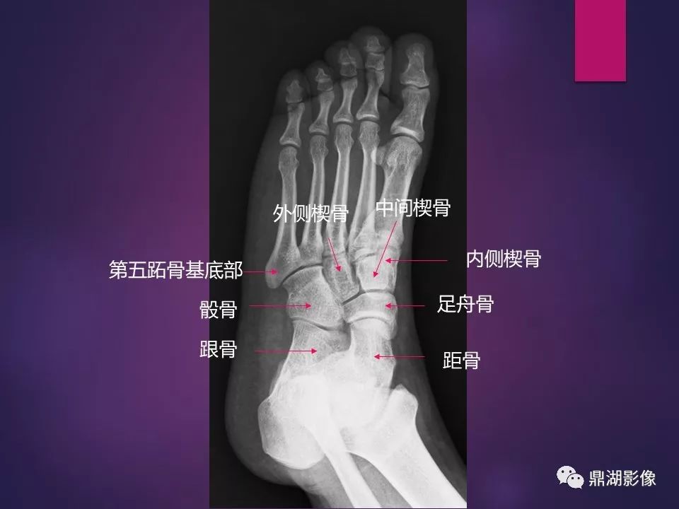影像PPT - 【PPT】骨骼肌肉系统医学影像解剖-17