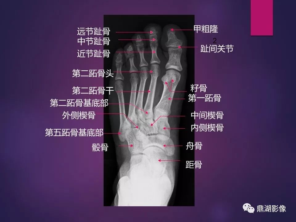 影像PPT - 【PPT】骨骼肌肉系统医学影像解剖-16
