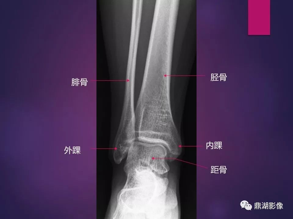 影像PPT - 【PPT】骨骼肌肉系统医学影像解剖-18
