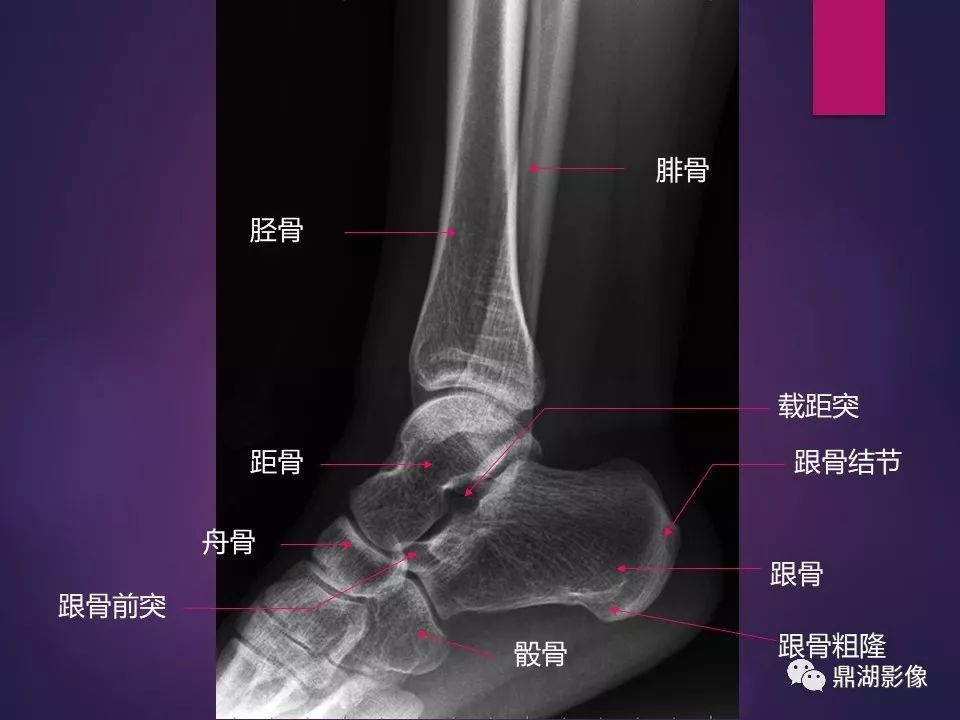 影像PPT - 【PPT】骨骼肌肉系统医学影像解剖-19