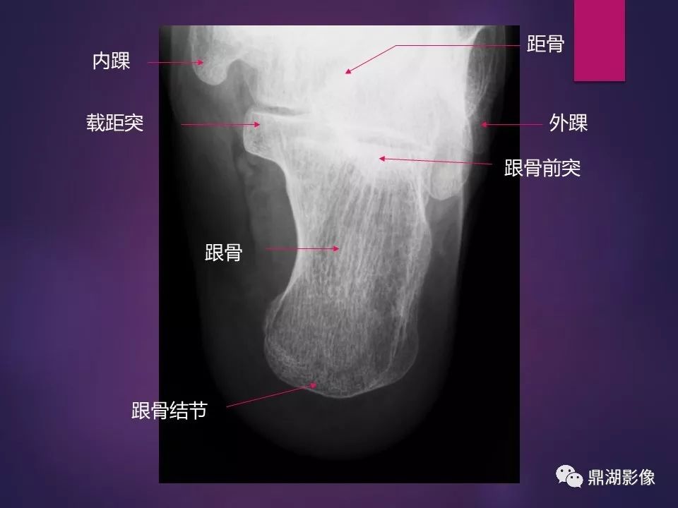 影像PPT - 【PPT】骨骼肌肉系统医学影像解剖-20