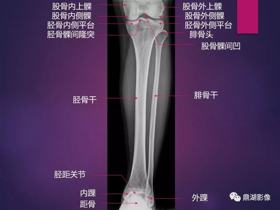 影像PPT - 【PPT】骨骼肌肉系统医学影像解剖-23