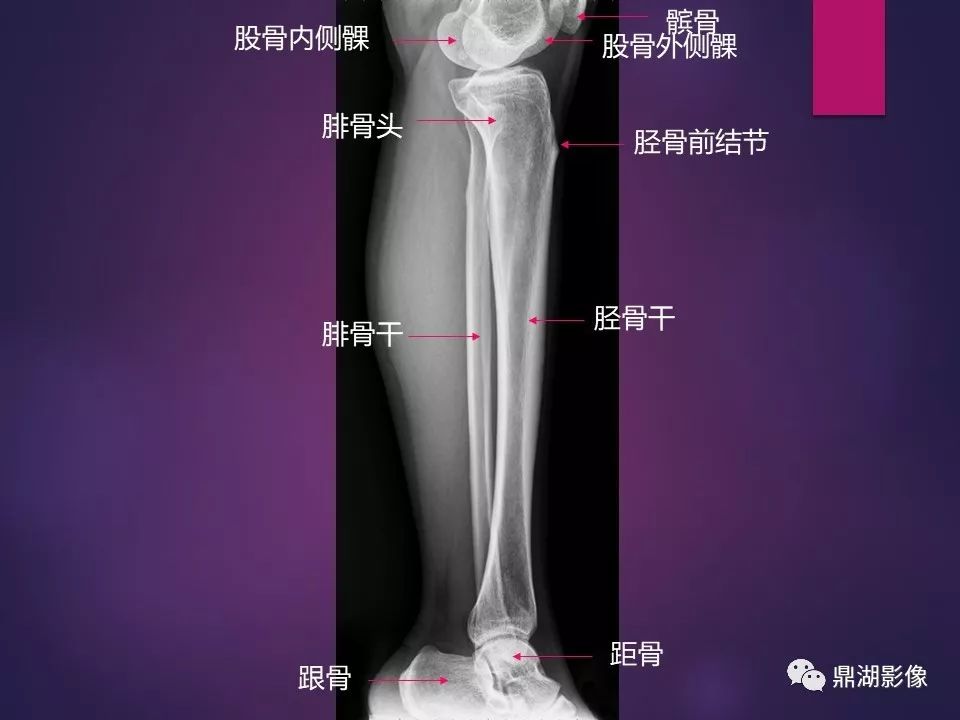 影像PPT - 【PPT】骨骼肌肉系统医学影像解剖-24