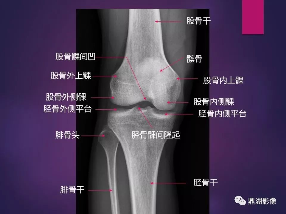 影像PPT - 【PPT】骨骼肌肉系统医学影像解剖-25