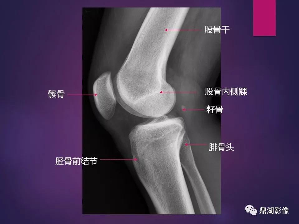影像PPT - 【PPT】骨骼肌肉系统医学影像解剖-26