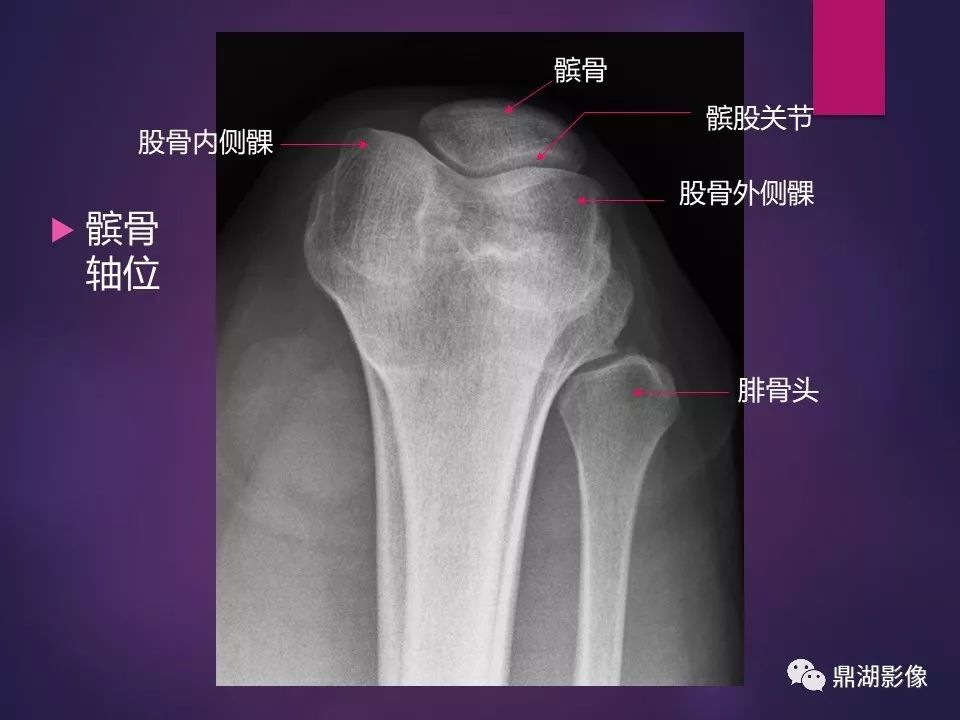 影像PPT - 【PPT】骨骼肌肉系统医学影像解剖-27
