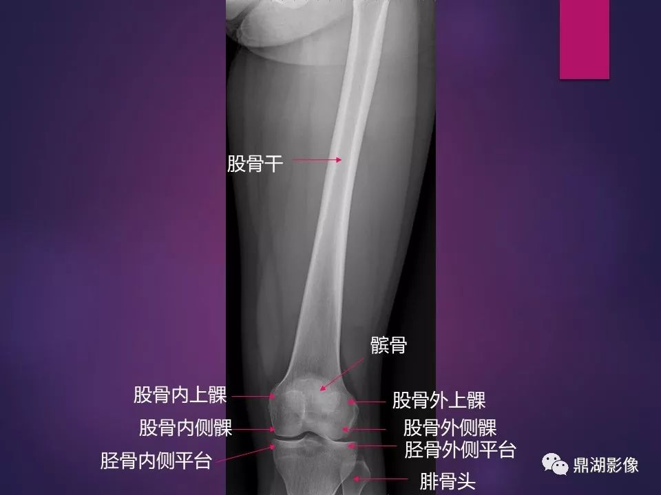 影像PPT - 【PPT】骨骼肌肉系统医学影像解剖-29