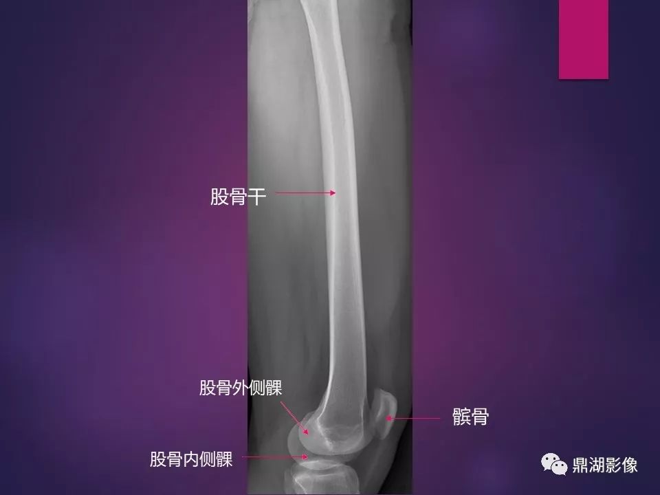 影像PPT - 【PPT】骨骼肌肉系统医学影像解剖-30