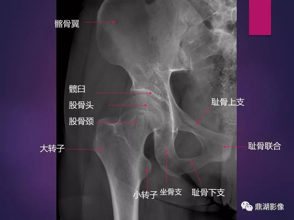 影像PPT - 【PPT】骨骼肌肉系统医学影像解剖-31