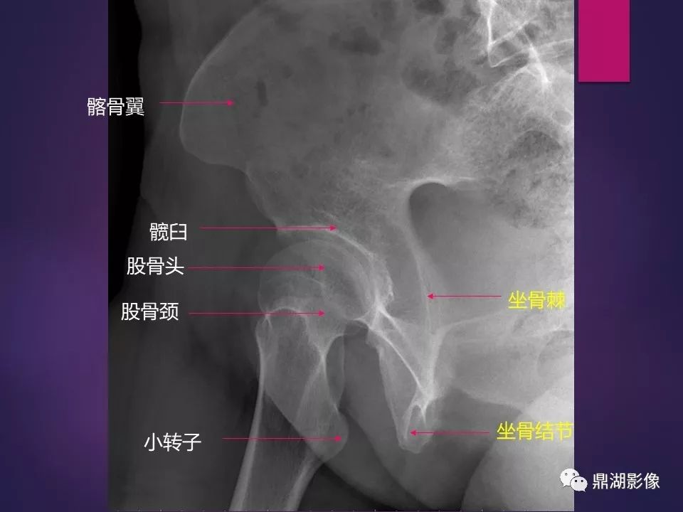 影像PPT - 【PPT】骨骼肌肉系统医学影像解剖-32