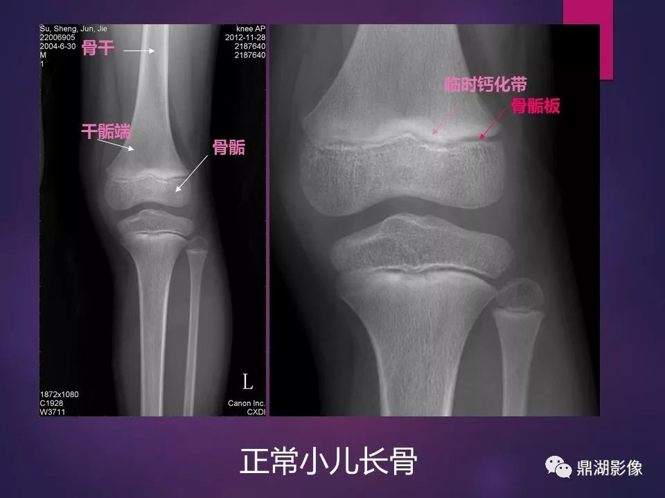 影像PPT - 【PPT】骨骼肌肉系统医学影像解剖-34