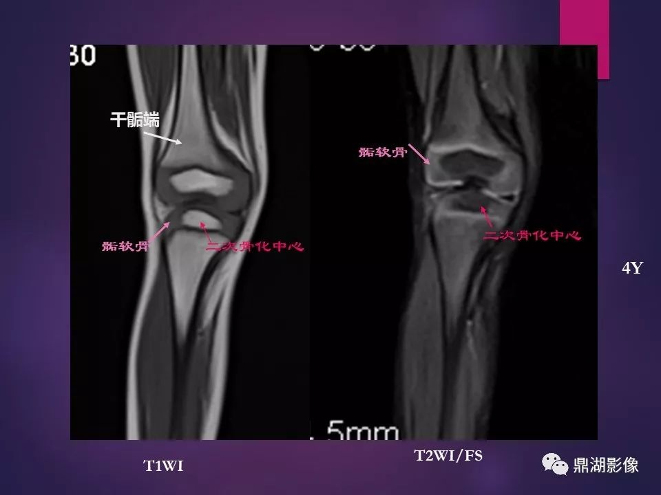 影像PPT - 【PPT】骨骼肌肉系统医学影像解剖-35